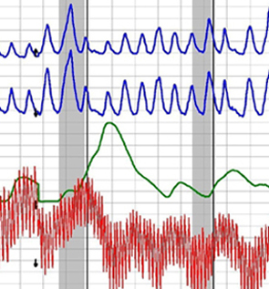 Burbank polygraph test for the public